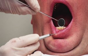Why Never Skip Regular Dental Appointments?